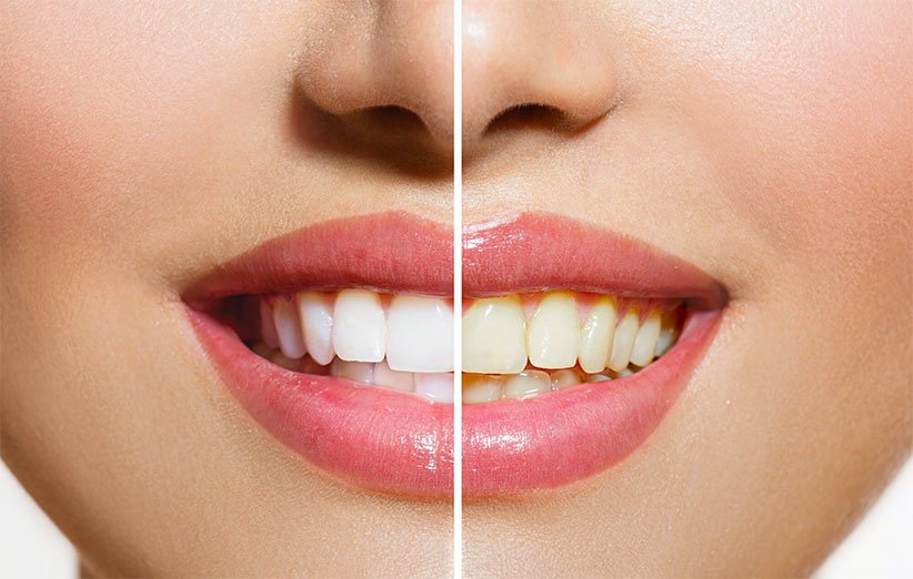 سفید کردن دندان در فتوشاپ مرحله به مرحله